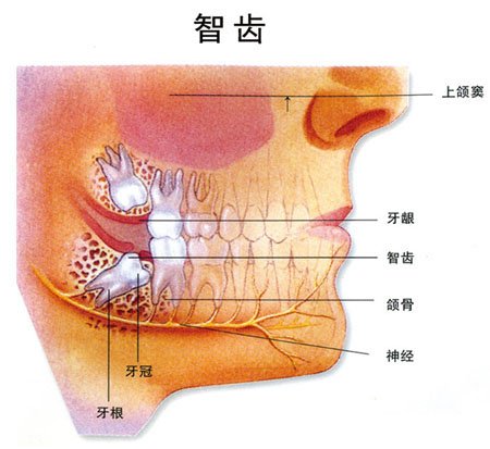 郑州口腔医院拔智齿多少钱