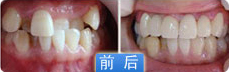三十岁还可以整牙吗